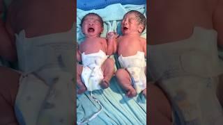 Cute Twins Baby 