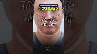 이중턱 튠라이너 시술과정 대공개