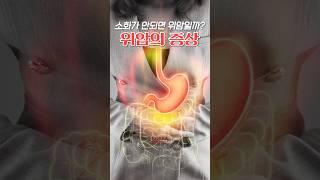 위암의 80%는 무증상 [암팩트]