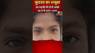 #इस लड़की की दोनों आंखों का रंग है अलग अलग। #shorts #अजूबा #girl  #unique #eye 