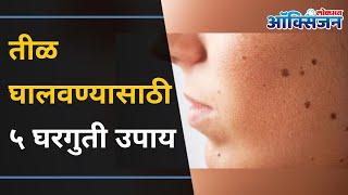 तीळ घालवण्यासाठी ५ घरगुती उपाय | How to Remove Skin Tags and Moles? | Home Remedies | Lokmat Oxygen