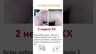 Хемохим - Атоми