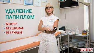Удаление папиллом в Ростове-на-Дону | Центр Дерматологии УРО-ПРО