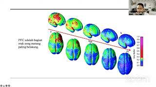 Perkembangan dan Neuroplastisitas Otak