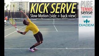 Topspin Kick Serve Slow Motion [Side and Back View]