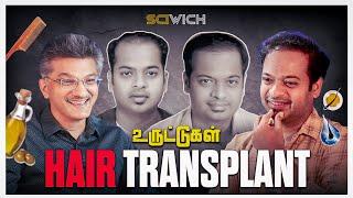 Hair Transplant பண்ணக்கூடாதா?  இதெல்லாம் பொய்யா? Dr.Murugu Sundaram #Sciwich | Mr.GK