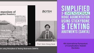 Simplified 3-dimensional Ridge Augmentation using StickyBone & Tenting Abutments [SANTA]