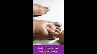 World Lymphedema Awareness Month