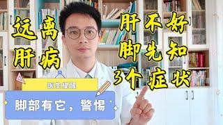 肝不好，腳先知！腳部出現3个症狀，可能是肝硬化或癌的徵兆，你的肝恐已開始衰竭！很多人卻還不知道！少吃4物，讓你遠離肝病