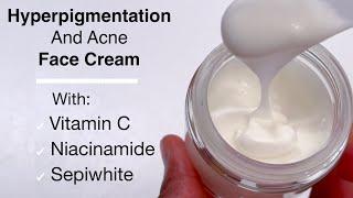 Hyperpigmentation And Acne Face Cream With Vitamin C, Niacinamide And Sepiwhite (Very Effective)