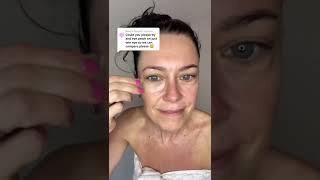 Eye Wrinkle Patch Results on One Eye | Wrinkles Schminkles Silicone Wrinkle Patches