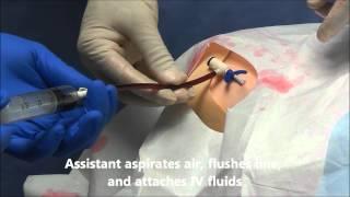 Pulmonary Artery (Swan Ganz) Catheter Insertion