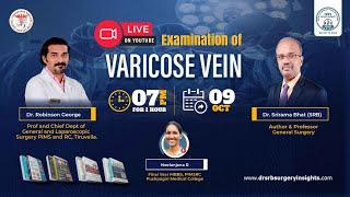 Varicose Vein Examination with Dr. Robinson George | Dr. Srirama Bhat (SRB)