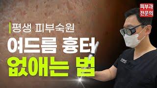 여드름 흉터 치료 총정리! 과연 얼마나 좋아질까?- 여드름 흉터 없애는 법