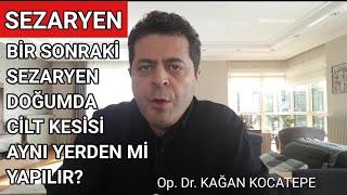 İKİNCİ VE SONRAKİ SEZARYENLERDE CİLT KESİSİ AYNI YERDEN Mİ YAPILIR? İYİLEŞMEYİ OLUMSUZ ETKİLER Mİ?