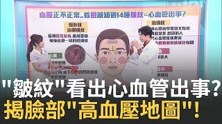 "耳垂一道+抬頭紋深" 死於心血管疾病機率更高?! 不是玄學!"眼乾、眼袋大、臉紅"高血壓看臉就知!｜主播 黃倩萍｜【醫點不誇張】20241223｜三立iNEWS