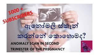 ඇයට Subscribers 1000 පසුකලා... අප සමග රැදුනු ඔබට ස්තූතියි...