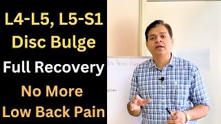 5 Steps For Disc Bulge Treatment, Low Back Pain Full Recovery, Herniated Disc Recovery Part-1