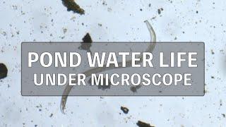 Pond water microorganism under microscope