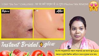 1 DAY *De-Tan * CHALLENGE : घर पर करें पार्लर से 10 गुना Effective TAN REMOVAL Remedy |No Dark Skin