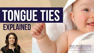 Tongue Ties Explained | Bolingbrook Family Chiropractic