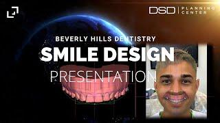 DESIGNING THE BEST SMILE MAKEOVER | Beverly Hills Dentistry