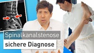 Spinalkanalstenose - häufige Ursache von Beinschmerzen richtig erkennen! ️