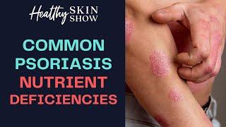 PSORIASIS Hidden Nutrient Deficiencies  | Jennifer Fugo