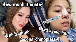 My Second Rhinoplasty Journey!