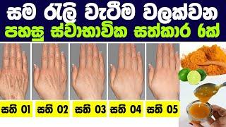 සම රැලි වැටීම වලක්වන පහසු ස්වාභාවික සත්කාර 6ක් | Anti-aging treatment to remove wrinkles