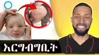 እርግብግቢት ምንድነው? መቼ ነው ስጋት የሚፈጥረው? Doctor JD