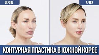 Остеотомия скул и челюсти в Корее | Европейская модель