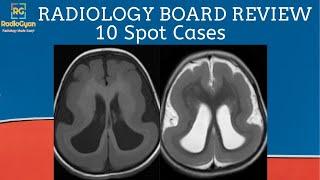 Radiology Board Core Exam Review Cases [Quiz and Discussion] | Set 10 | Sep 2020