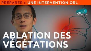 Information Patient | Ablation des végétations adénoïdes