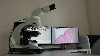 Cor Medical CorPath Software in action