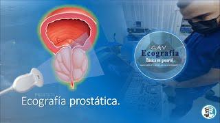 Ecografia prostatica