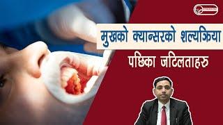 Oral Cancer Diagnosis: Understanding the Complications and Challenges | Dr. Prabhat Thakur