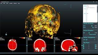 How to create Labels or Landmarks over 3D DICOM or Volume Images in Real3d VolViCon?