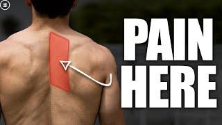 Rhomboid Pain (Shoulder Blade Discomfort)