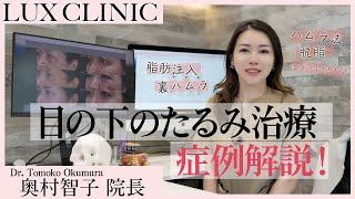 【目の下のたるみ治療について解説します！】クマ取り/脱脂/ハムラ法/ミッドフェイスリフト...