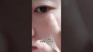 바세린을 눈가에 바르면 눈가 주름이 없어질까?!