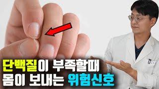 단백질이 부족할때 우리 몸에서 이런 '위험 신호'를 보냅니다. 이런 증상이 있으면 단백질 꼭 챙겨드세요 (이럴때 단백질 보충제는 이걸 드세요)