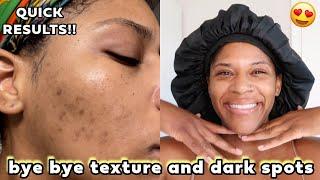 I Fixed My Skin in 2024 with This Morning and Night Routine | Improve texture and dark spots