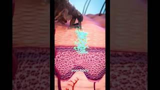 Cholesterol Animation, Medical Animation, Amerra Medical Visualization, patient education, #amazing