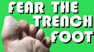 IMPORTANT! TRENCH FOOT Symptoms and prevention