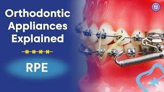 Orthodontic Appliances Explained | RPE