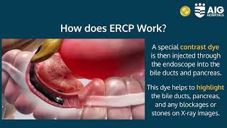 ERCP (Endoscopic Retrograde Cholangiopancreatography) | AIG Hospitals