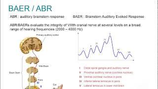 Natus EP Webinar: Clinical Auditory Evoked Potentials