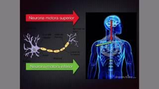 Neurona motora superior e inferior