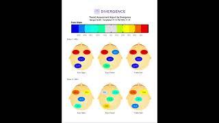 Exploring the Mind of an Advanced Meditator Pt 2  #brainwave #brainwaveentrainment #neurocognitive